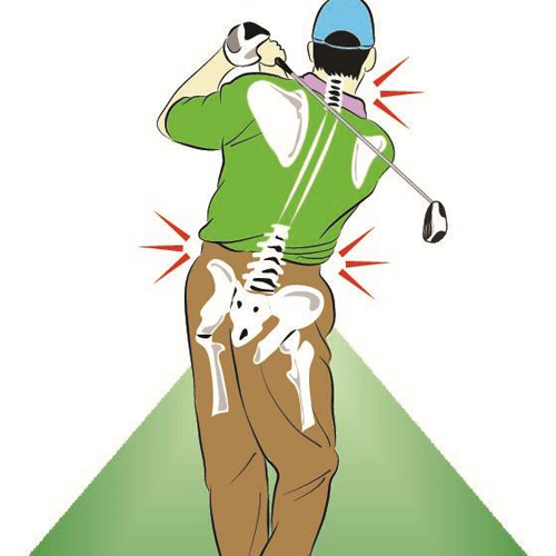 golf pain