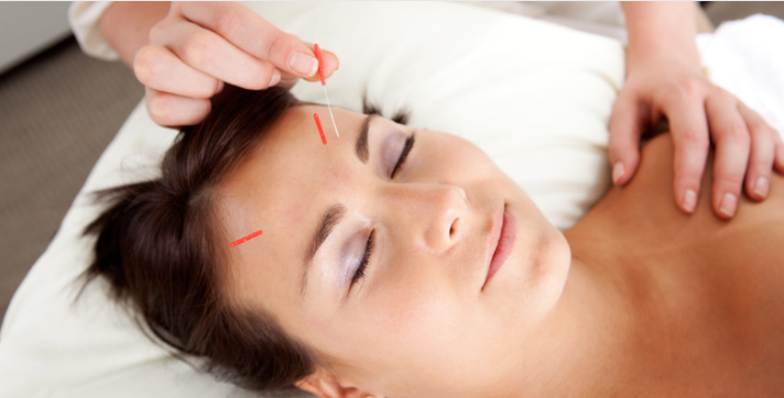 Beyond Needles: Exploring Different Acupuncture Techniques